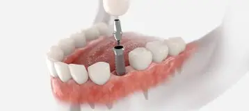 Urgent Dental Assistance Richmond