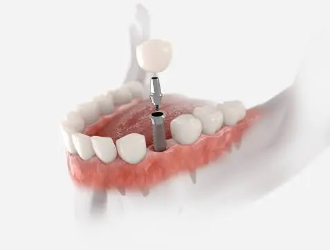 Urgent Dental Assistance Richmond