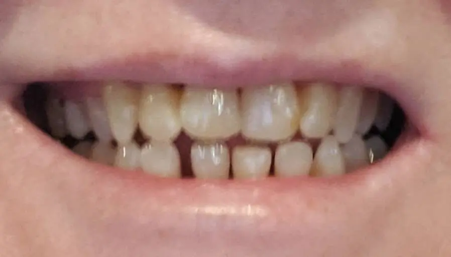 Dentistry of the Carolinas - East Charlotte