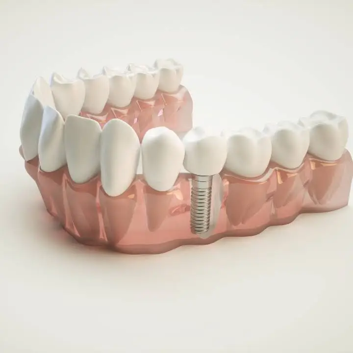 Aten & Garofalo Dentistry - Ballantyne