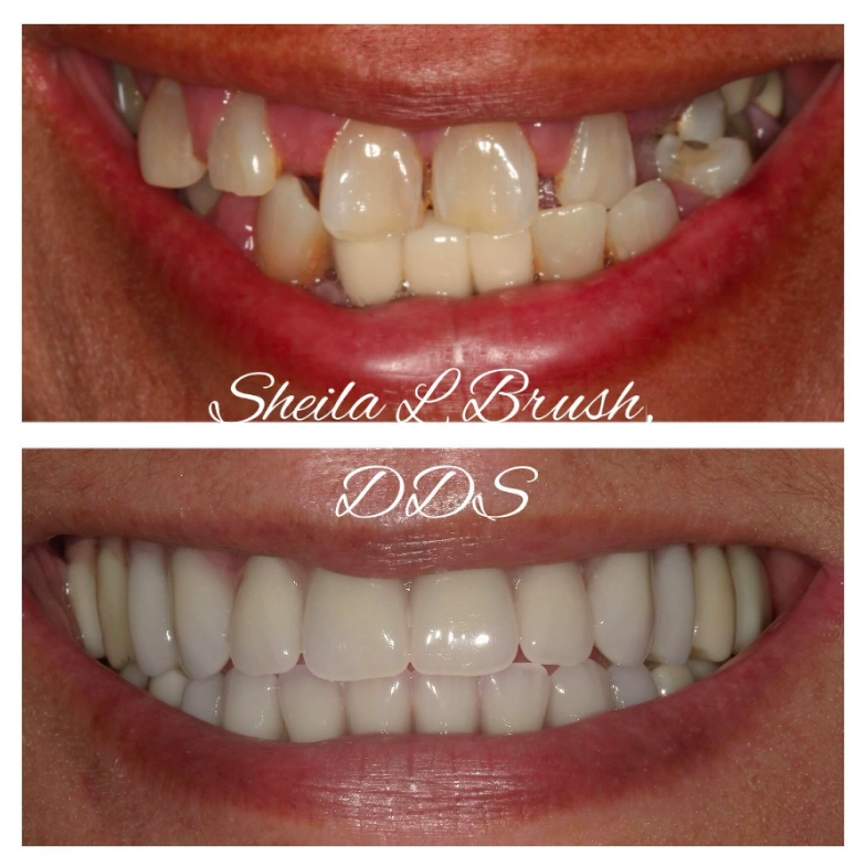 Sheila L. Brush, DDS, PC