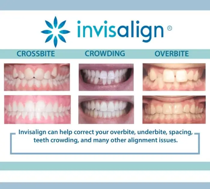 Ellicott City Family Dentistry
