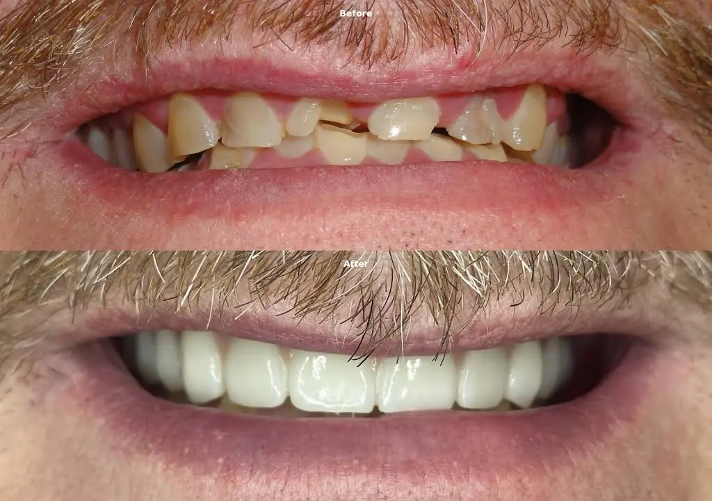 Preferred Dental