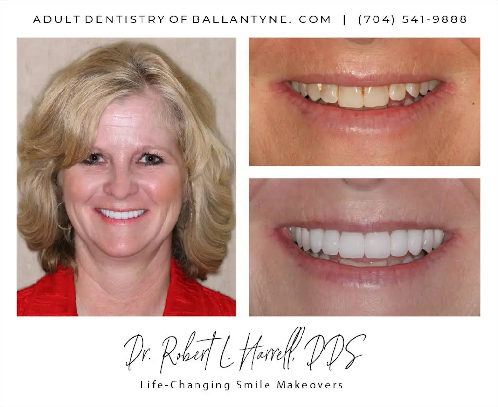 Adult Dentistry of Ballantyne