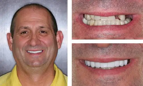 Adult Dentistry of Ballantyne