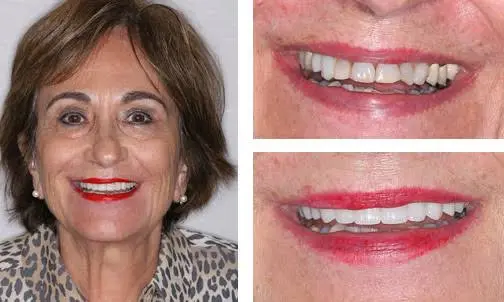 Adult Dentistry of Ballantyne