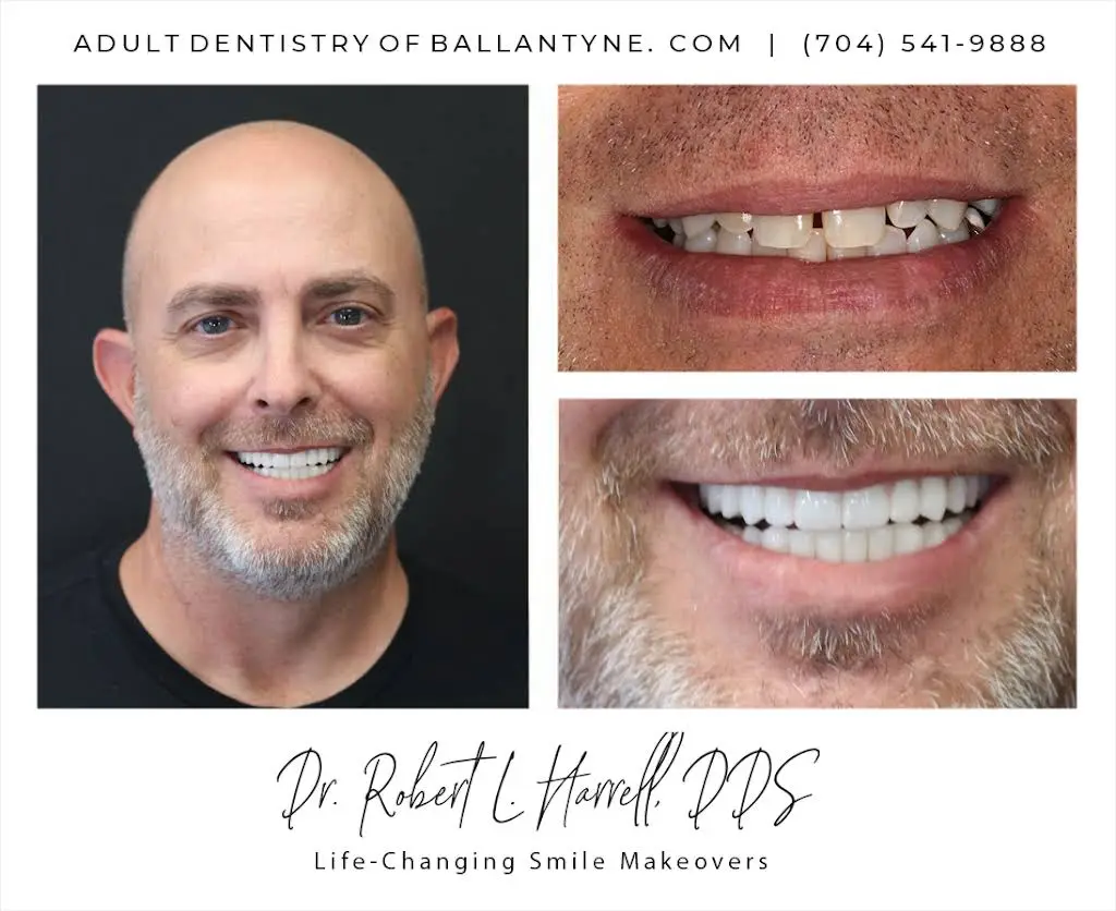 Adult Dentistry of Ballantyne
