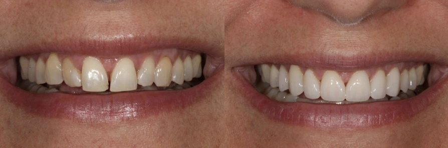 Advanced Dentistry of Blakeney