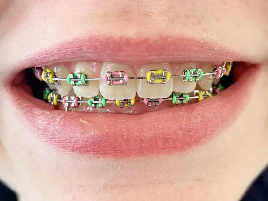 Koerich Orthodontics
