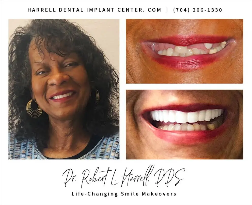 Harrell Dental Implant Center