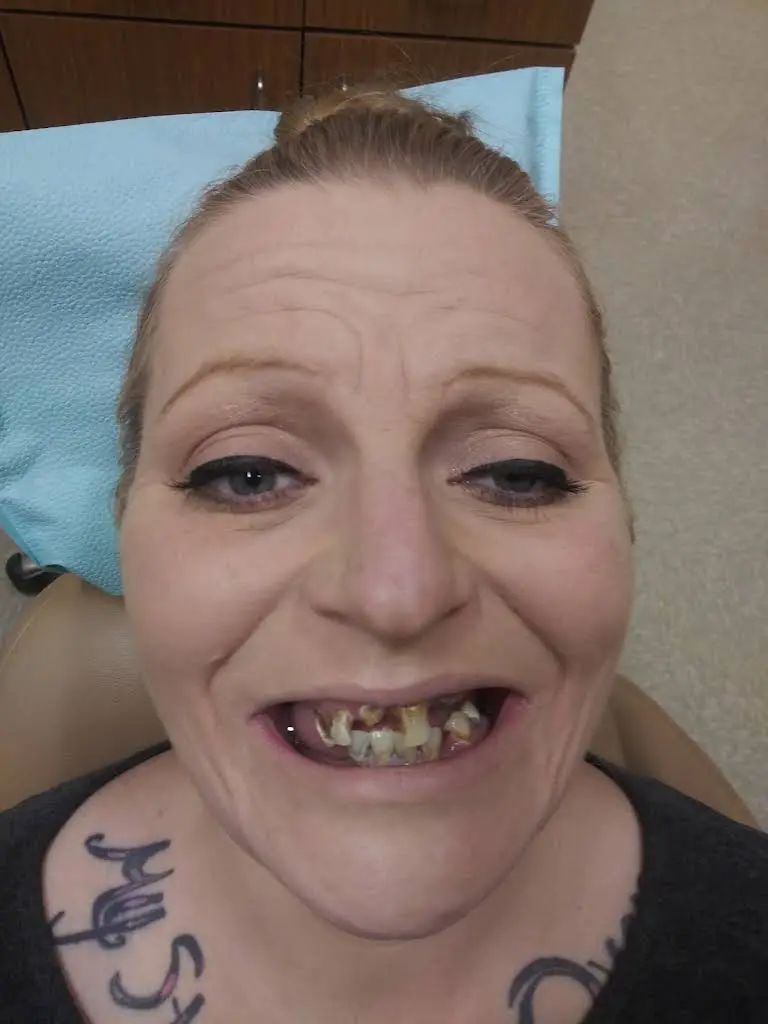 Affordable Dentures & Implants