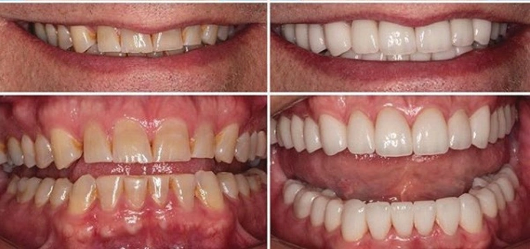 Schein Dental