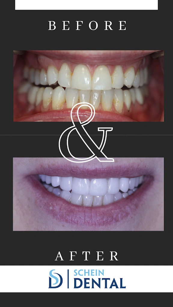 Schein Dental