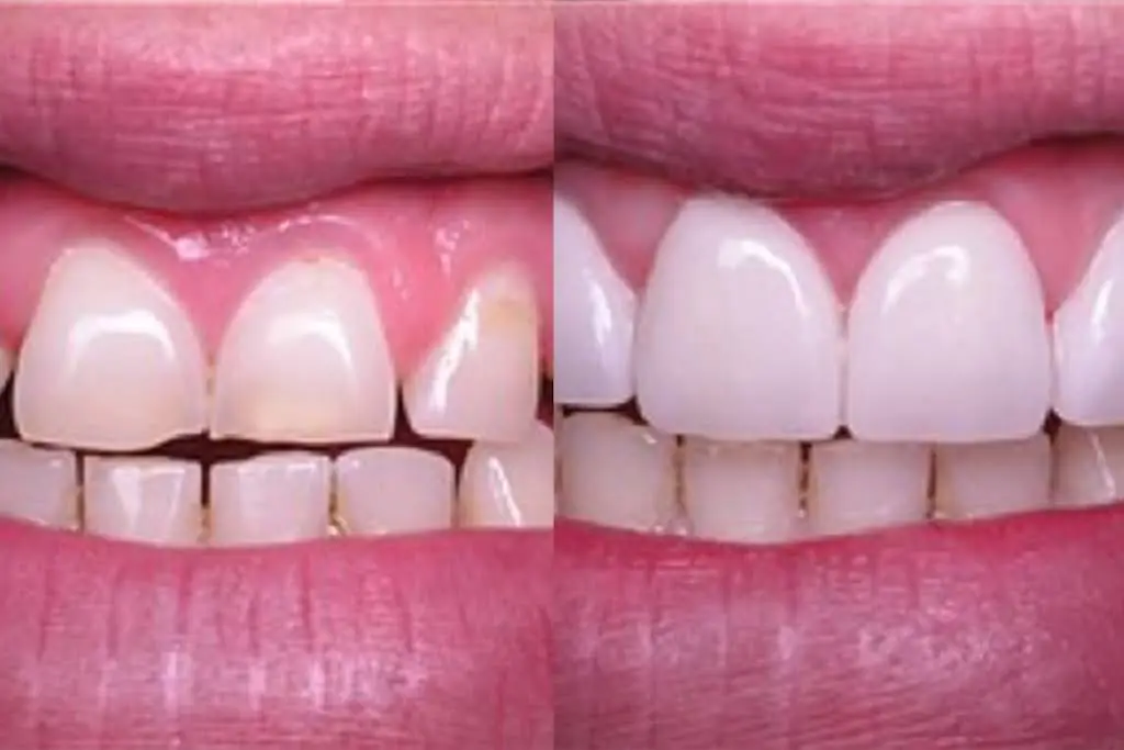 Dr. Robert Lloyd Dentistry