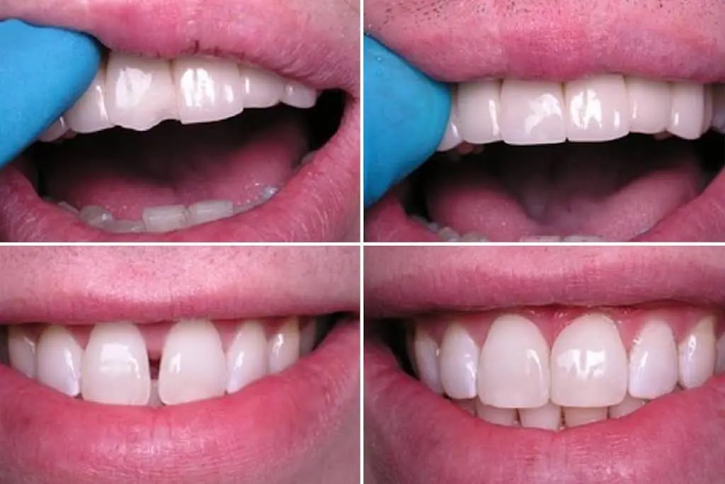 Dr. Robert Lloyd Dentistry