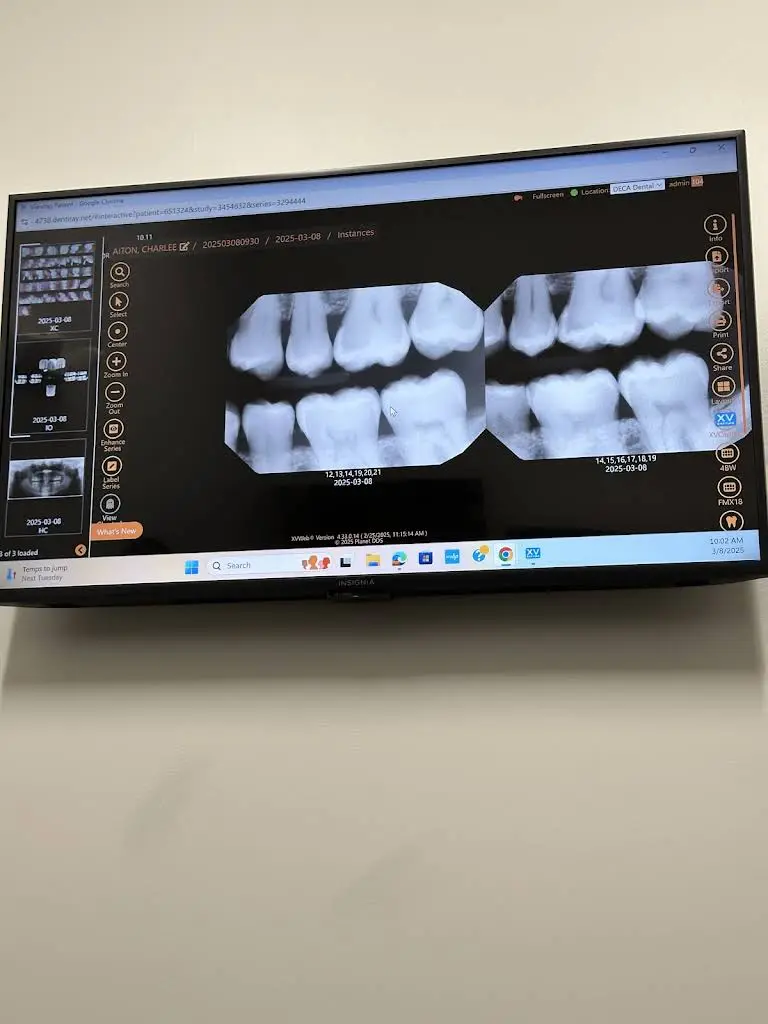 Ideal Dental Rock Hill