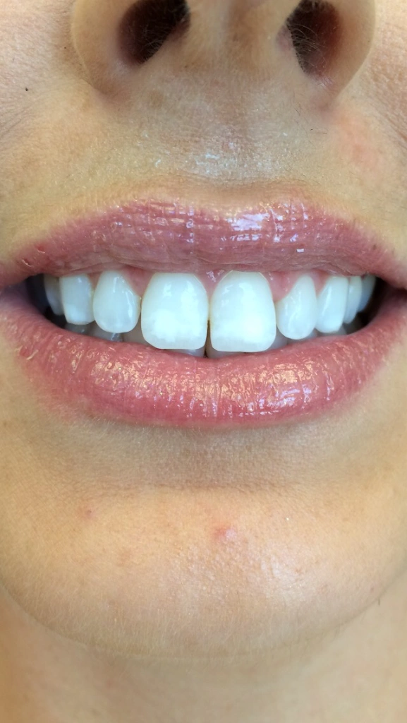 Wellenreiter Dentistry at Blakeney