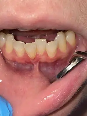 Hillsborough Periodontics and Implants Hana C Hobbs DDS, MS