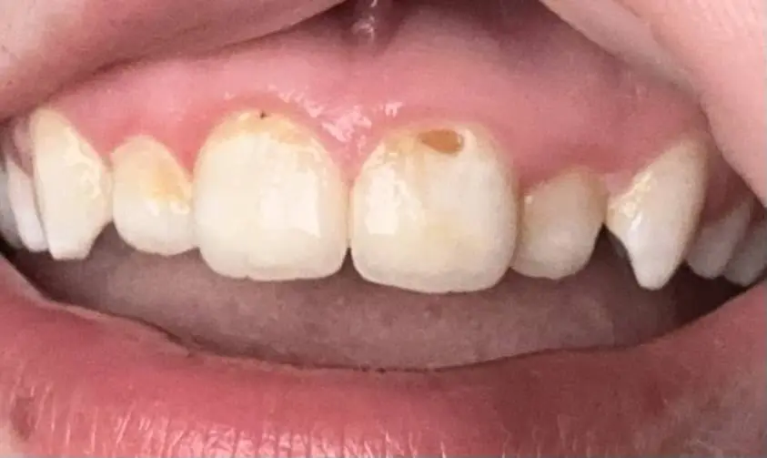 Aspen Dental