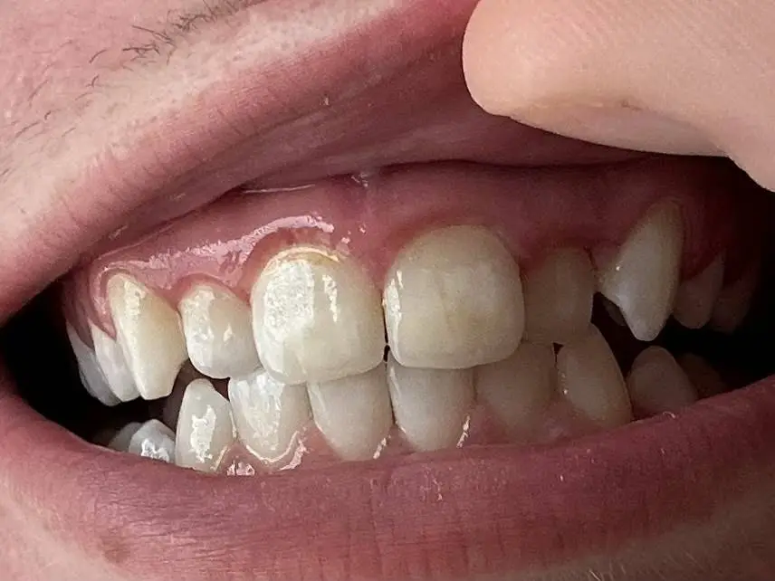 Aspen Dental