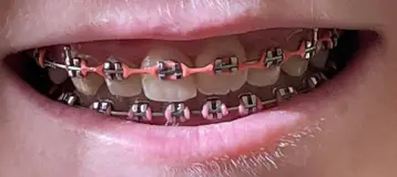 Signature Smiles Orthodontics