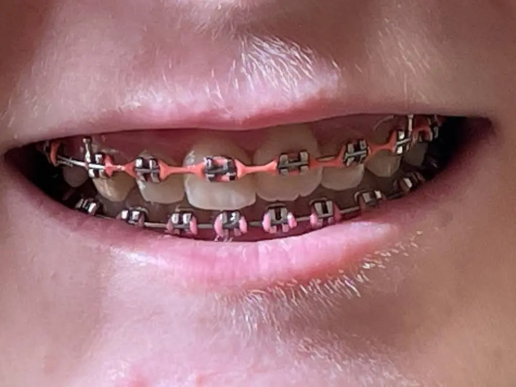 Signature Smiles Orthodontics