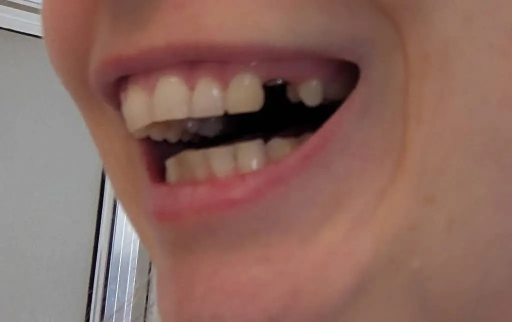 Carolina Implant