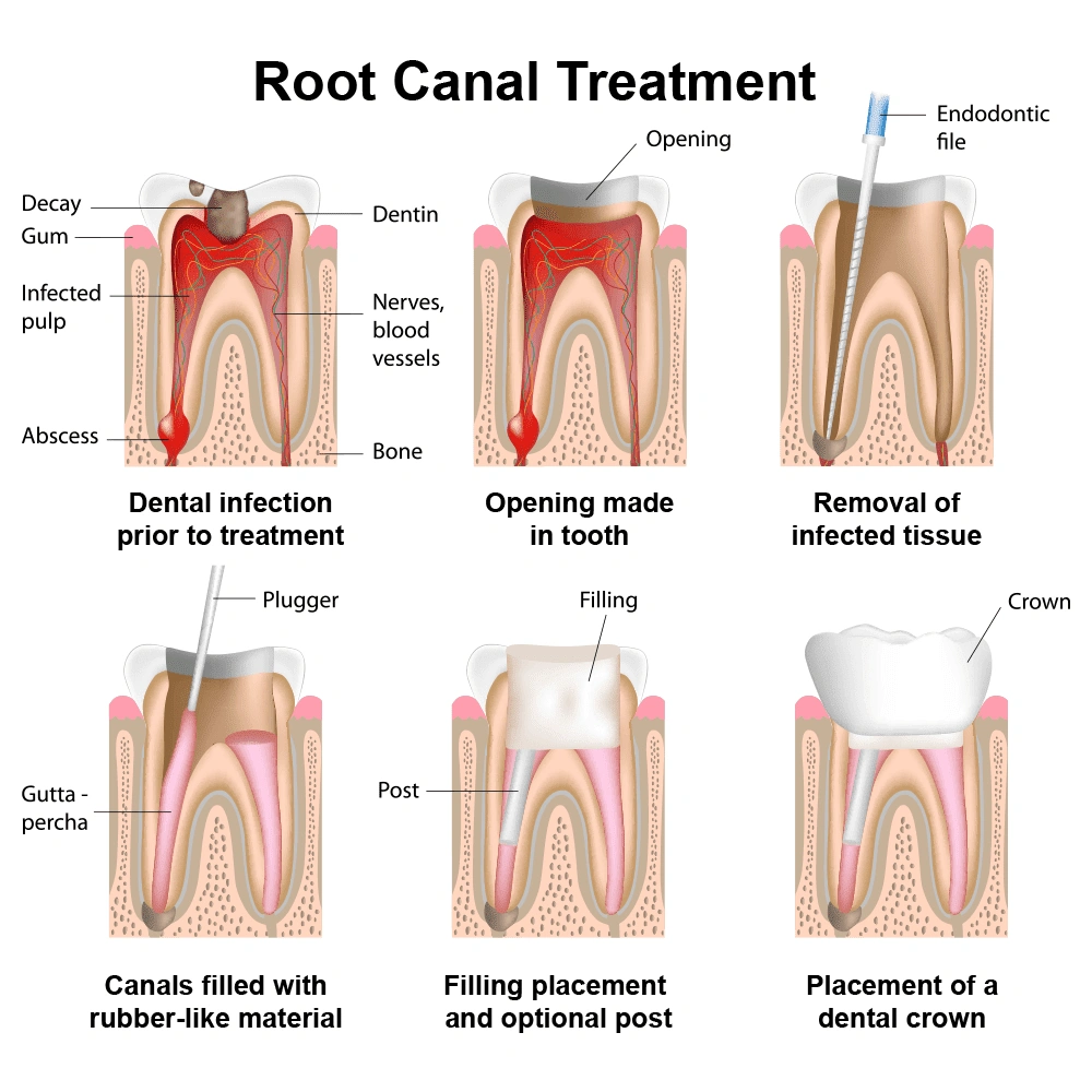 Apex Dental