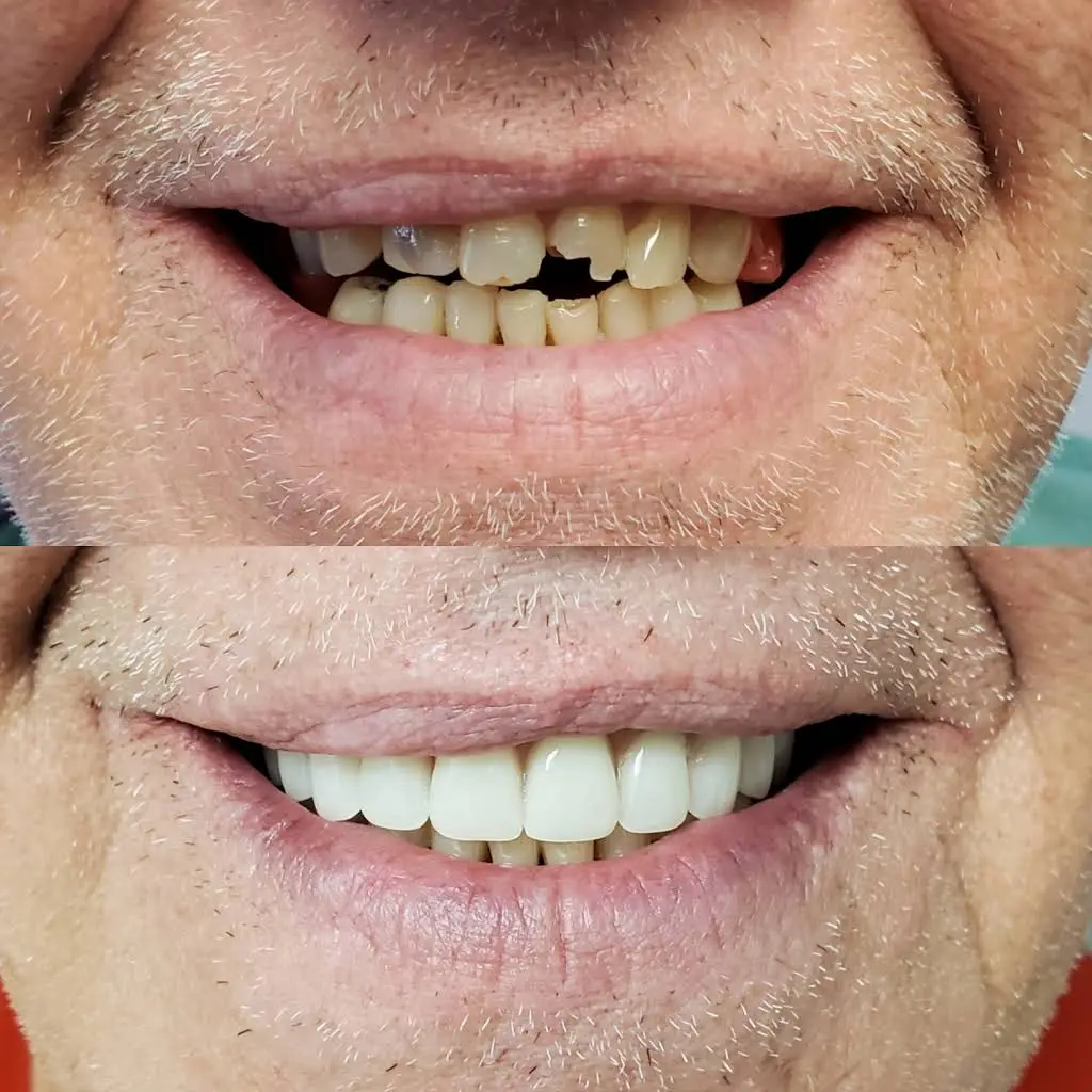 Premier Smiles & Implant Dentistry