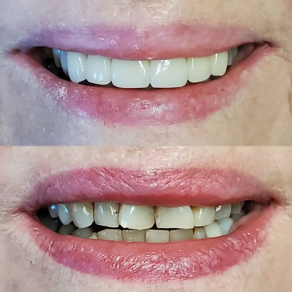 Premier Smiles & Implant Dentistry