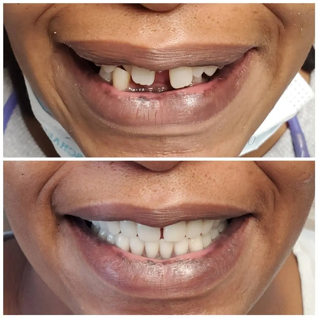 Premier Smiles & Implant Dentistry