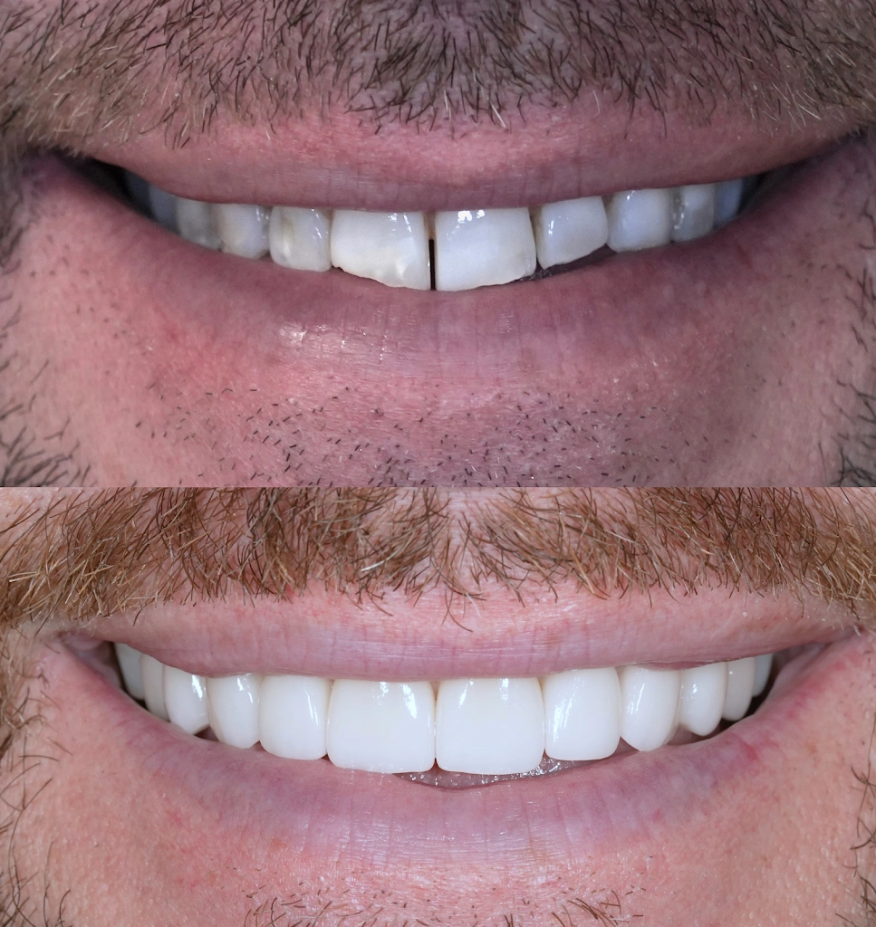 Premier Smiles & Implant Dentistry