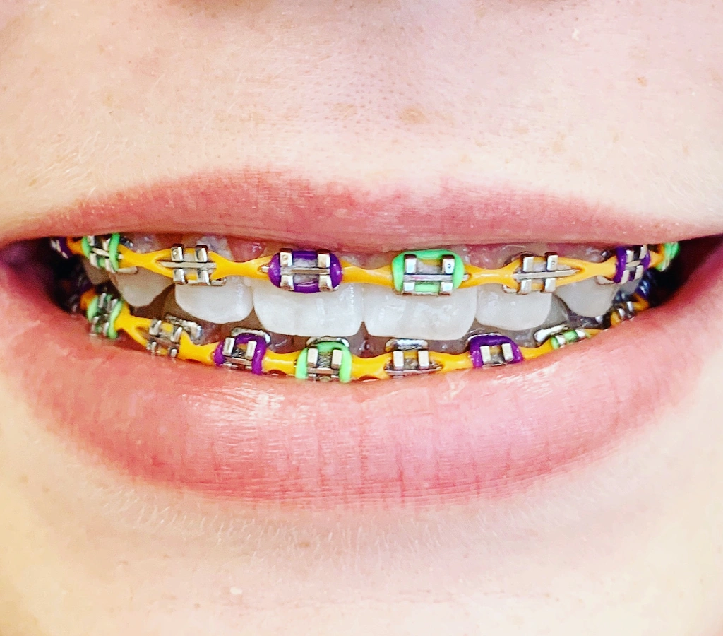 Koerich Orthodontics