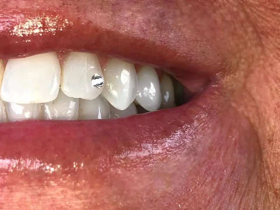 Colonial Dental Group