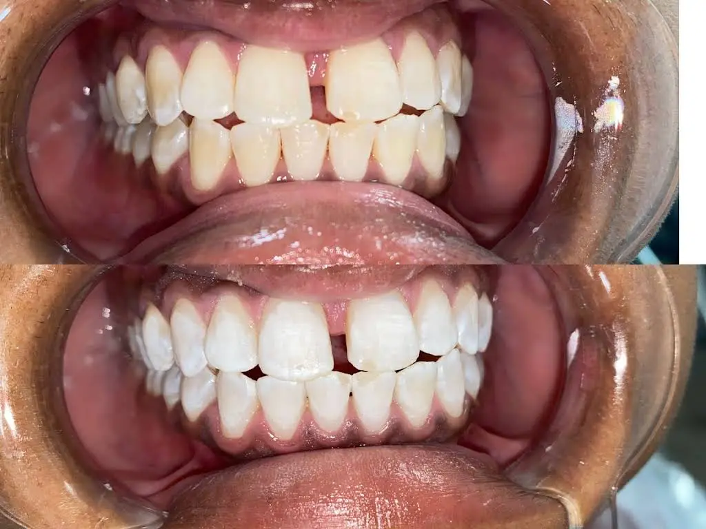 Providence Smiles Dental Care