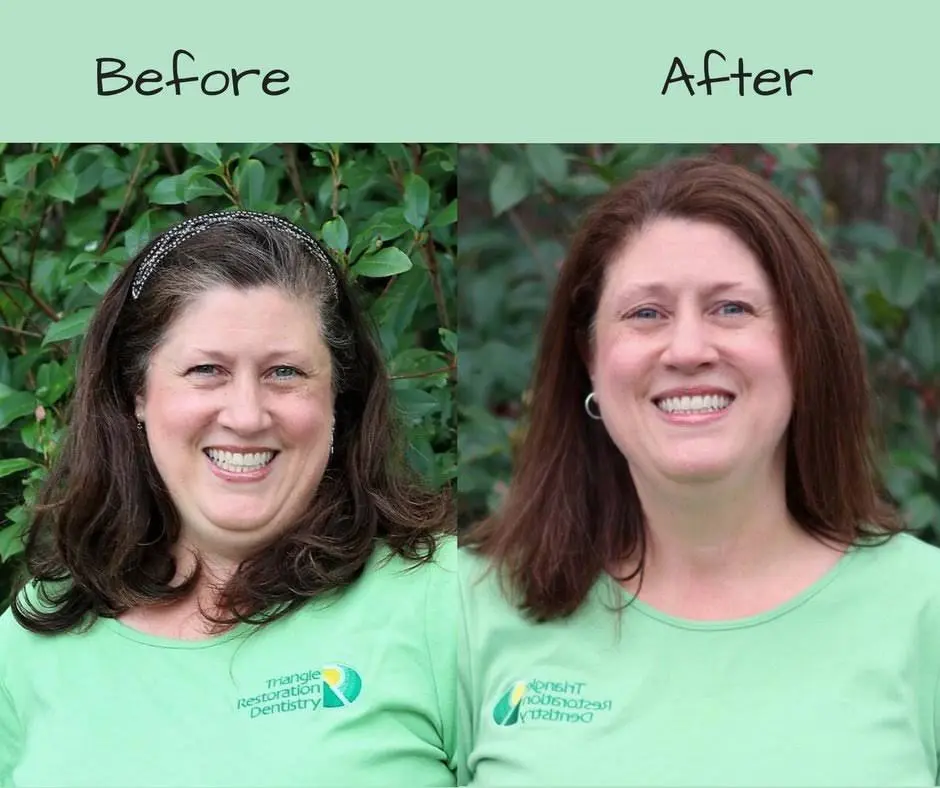 Triangle Restoration Dentistry