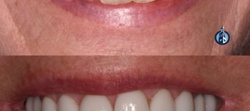Chapel Hill Family & Cosmetic Dentistry: James Furgurson, DDS