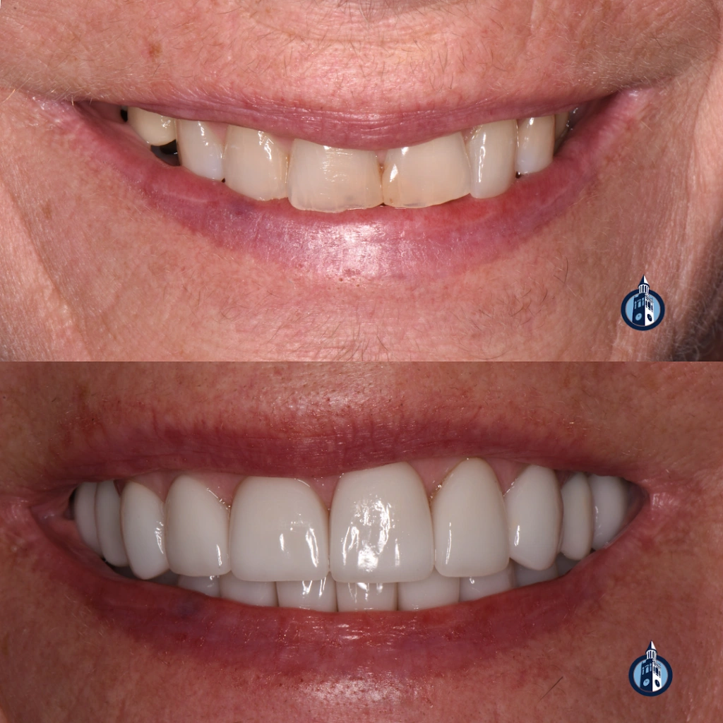 Chapel Hill Family & Cosmetic Dentistry: James Furgurson, DDS
