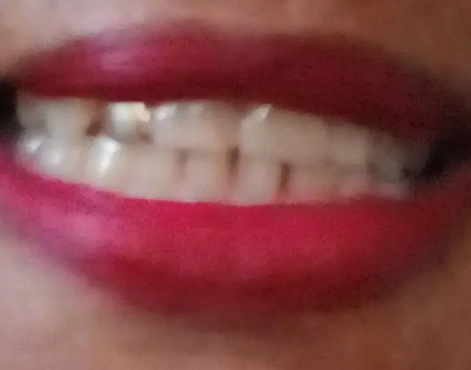 Commonwealth Dentistry