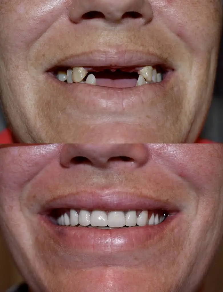 DentureCare and Implant Solutions