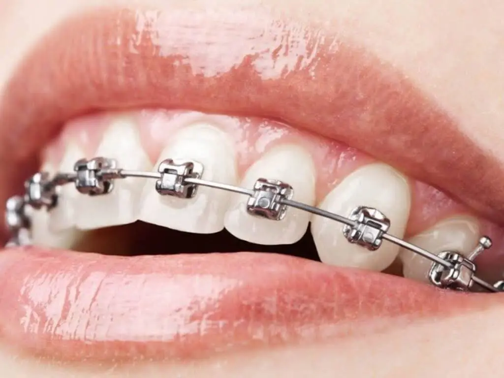 SP Orthodontics