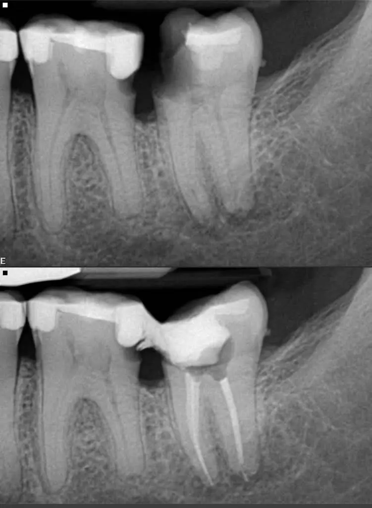 State Endodontics