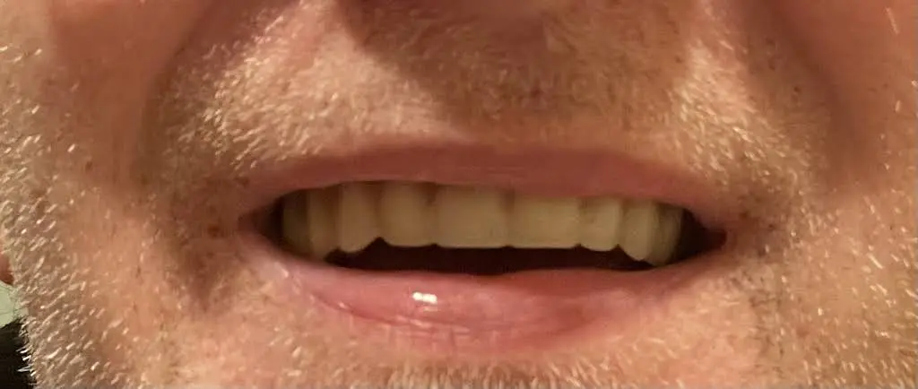 Penns Valley Dental Associates