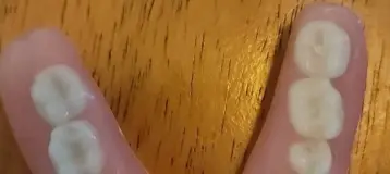 Aspen Dental