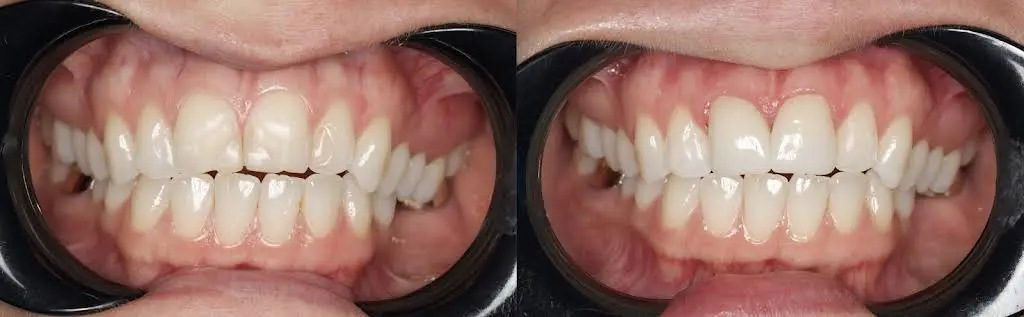 Eastern Pines Dental