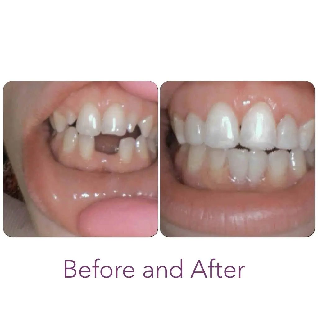 Alison L. Boone, DDS