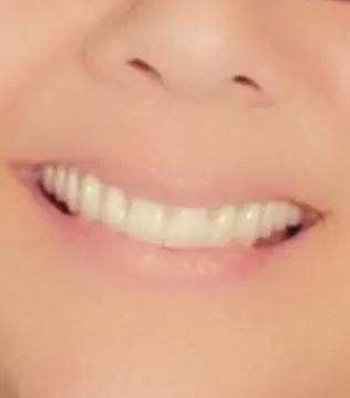 Dental Transformations