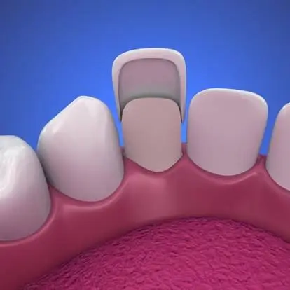 Turner Family Dentistry of Virginia