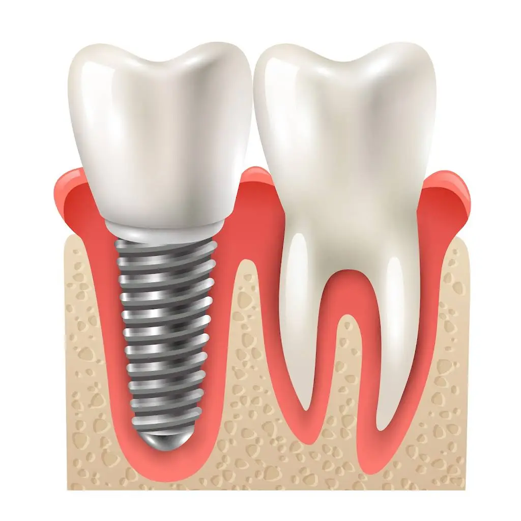 Mid-Penn Oral Surgery