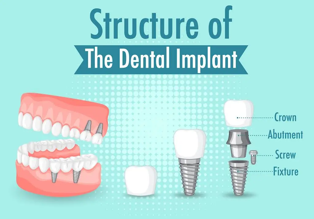 Mid-Penn Oral Surgery
